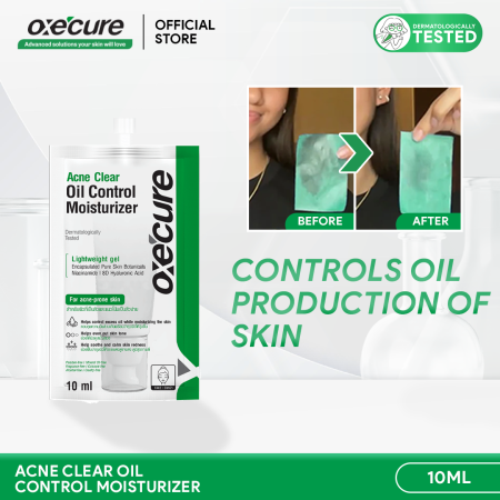 OXECURE Acne Clear Oil Control Moisturizer 10ml