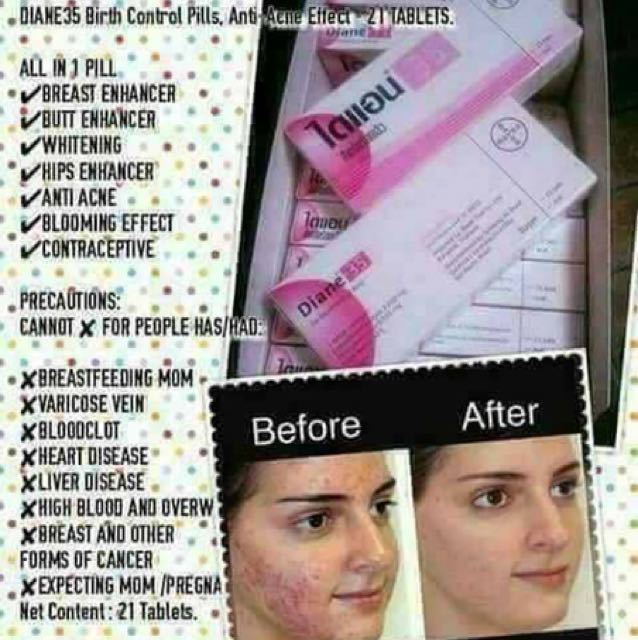 birth control diane 35 acne birth control diane 35 acne