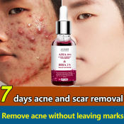 Original Acne Pimple Remover Cream by 