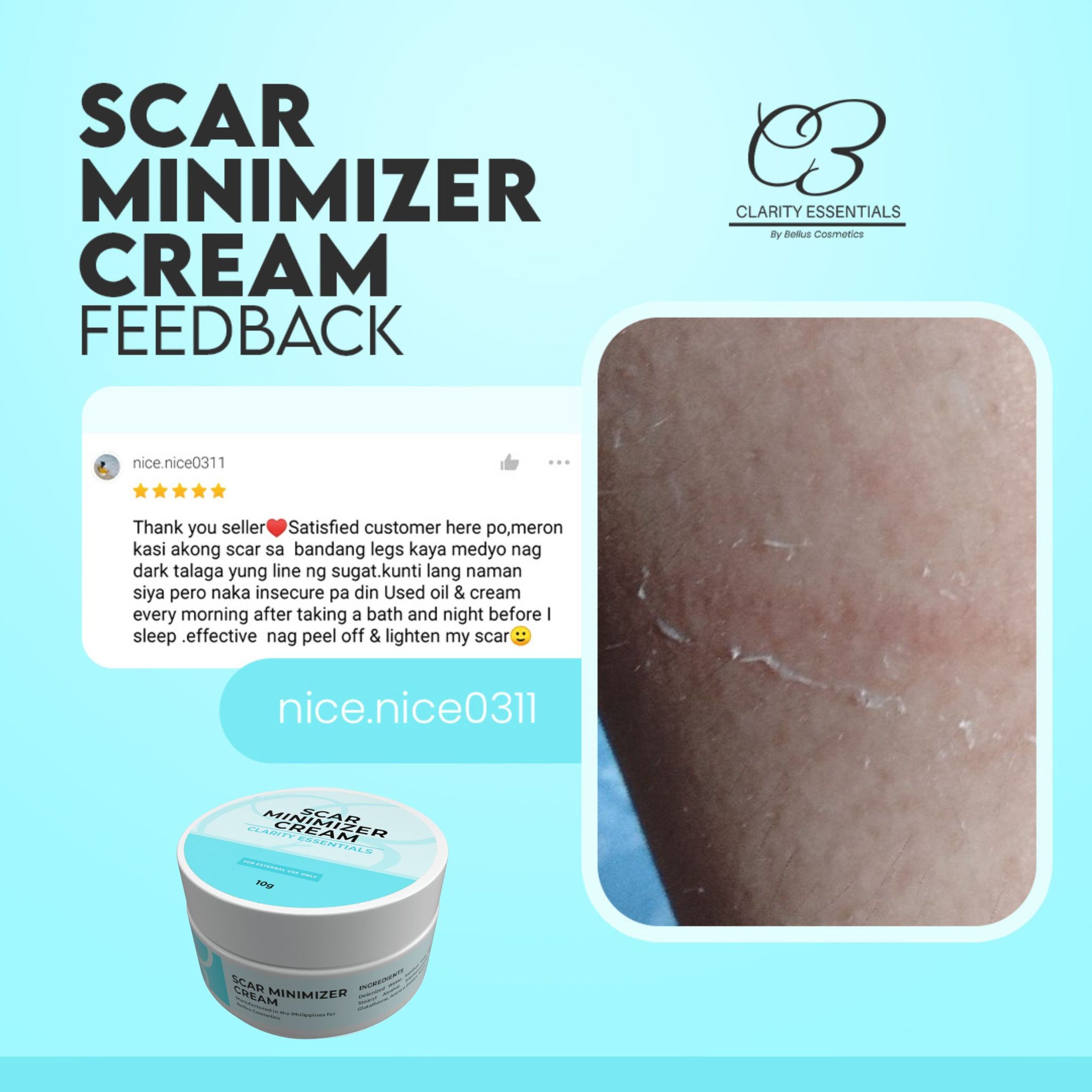 Scar Minimizer Cream by Clarity Essentials 💙#scarcream