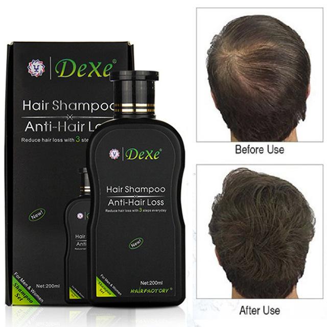Dexe Organic Hair Growth Anti Hair Loss Shampoo Hair Grower