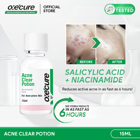 OXECURE 2% Salicylic Acid Acne Clear Potion 15ml