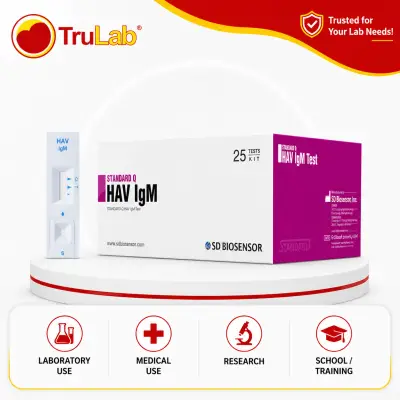 Trulab Hav Igm Standard 25TESTS Box Laboratory Supplies