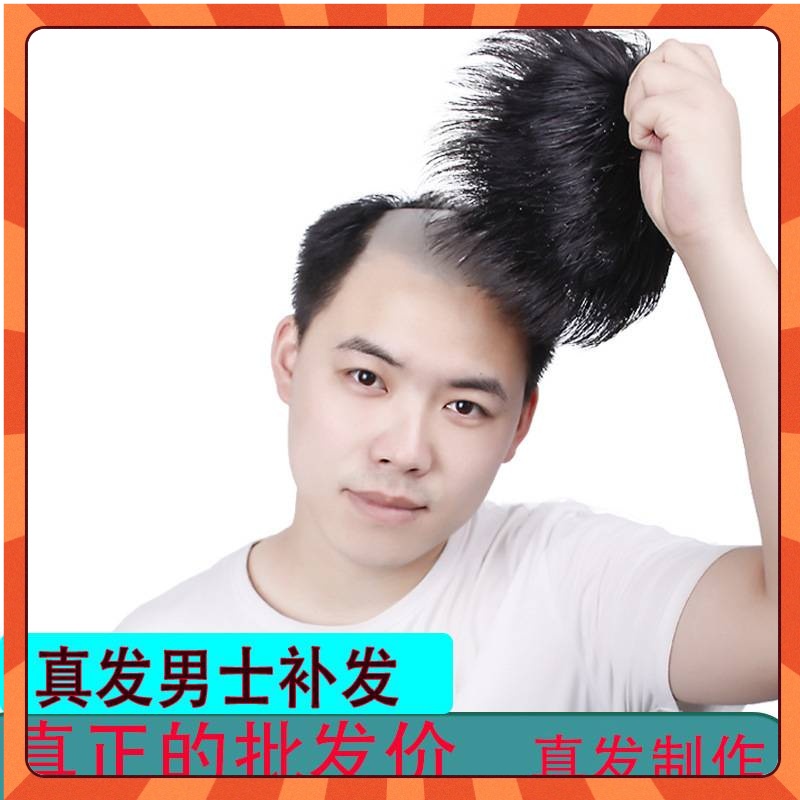 Shop Toupee Mens Online at Lazada Philippines – Best Prices