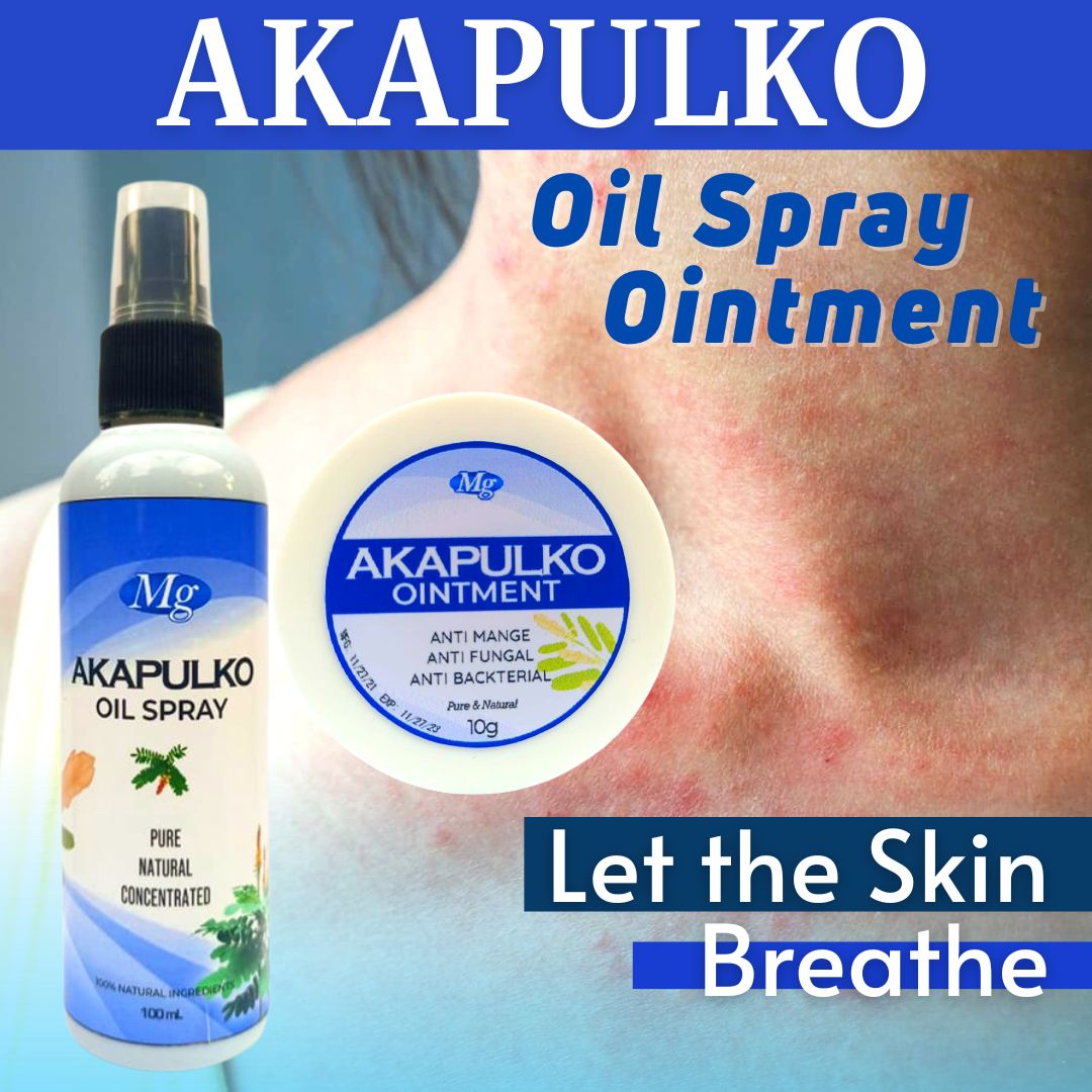 MG Akapulko Herbal Rash Cream: Firming, Healing, Allergy Relief