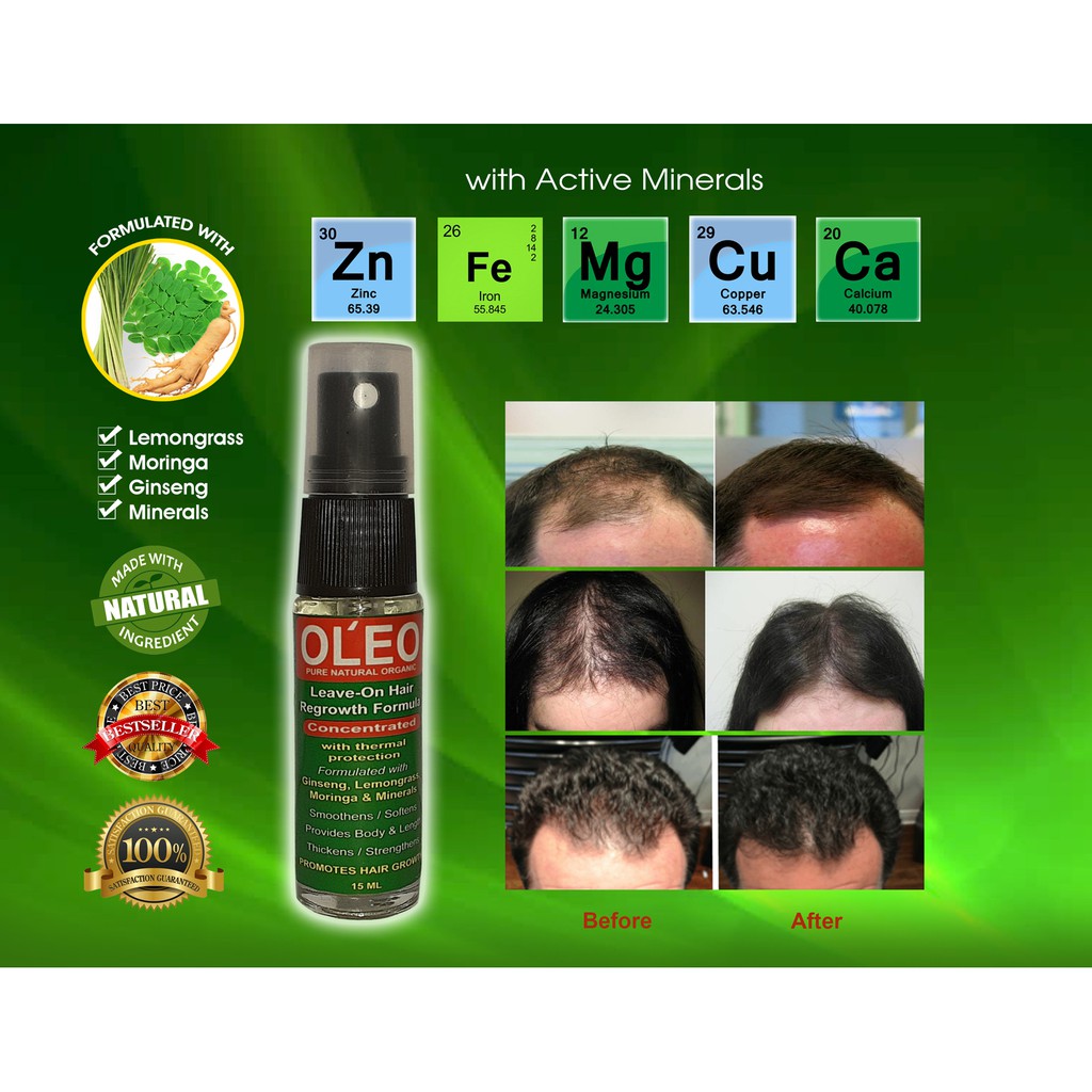 ✴OL'EO Leave-On Spray Hair Regrowth with Minerals SPF 30♝ | Lazada PH