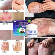 BaiXuanGao Anti-Fungal Ointment for Skin Conditions 