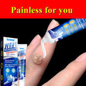 Original Warts Remover Cream by Skin Magic
