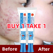 Pimple Eraser Acne Treatment Cream by Aloe Gelatine