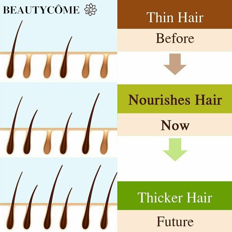 BEAUTYCOME Hair Growth Essence Liquid Anti Hair Loss Serum Fast Hair Growth  Treatment for Men/Women | Lazada PH