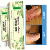 Zudaifu Natural Dermatitis & Eczema Ointment for Skin Conditions
