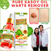 Kulogo Remover: Effective Warts and Skin Tags Treatment