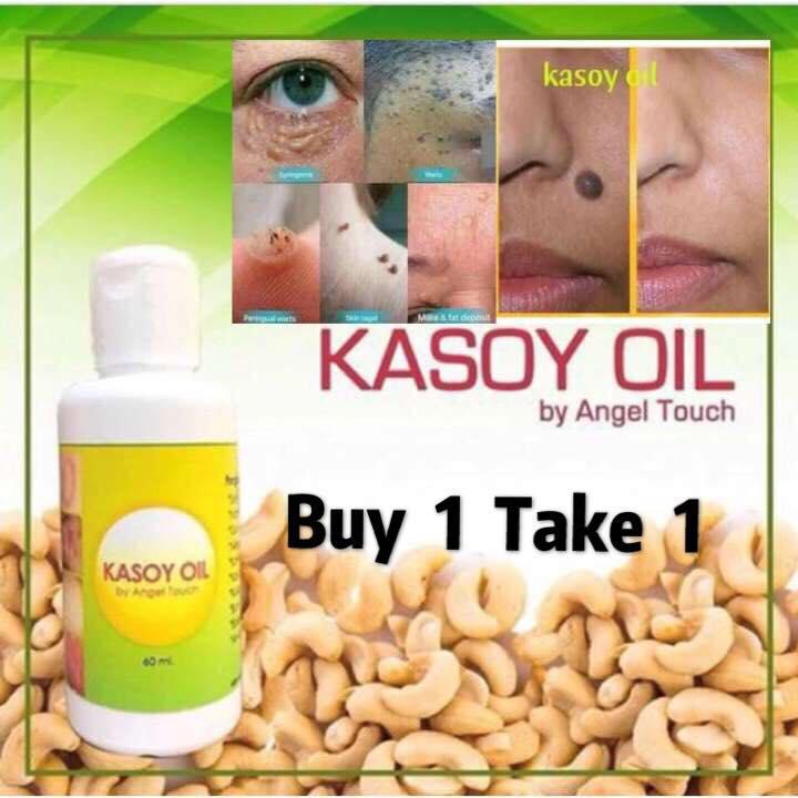 MZ adizai Warts Remover and Miracle Kasoy Oil