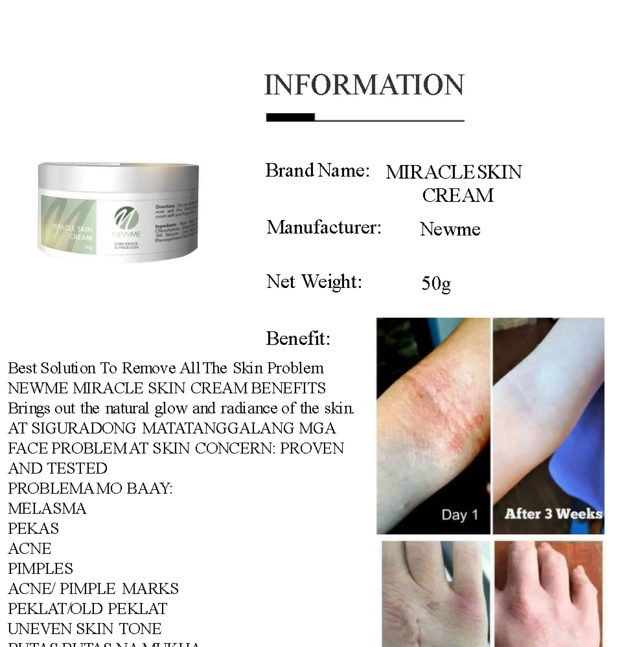 Featured image of post Steps to Prepare New Me Miracle Skin Cream Fda Approved