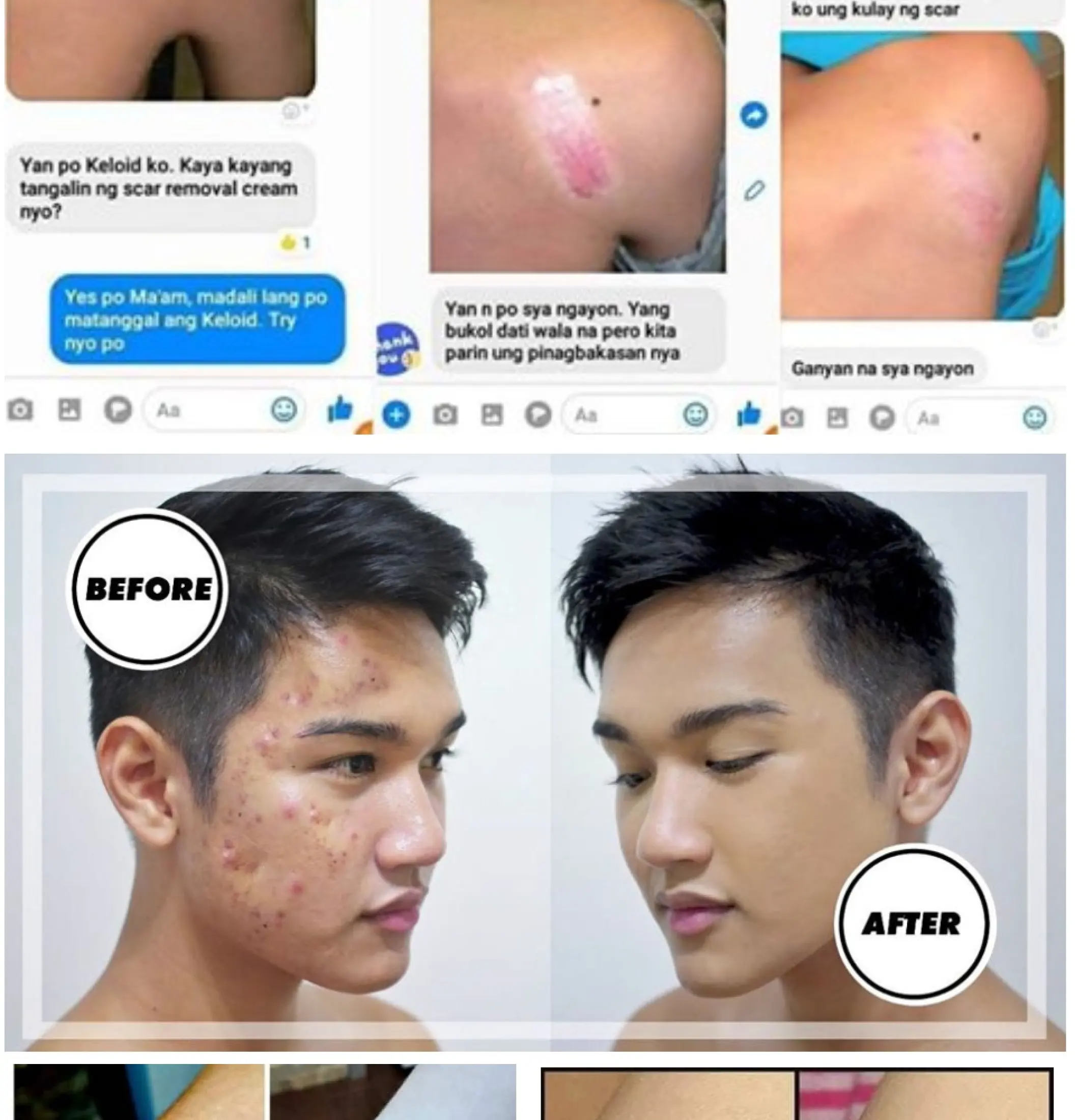 new me miracle cream benefits