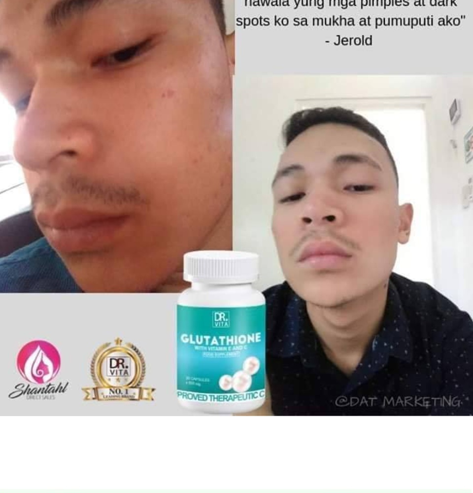 rich source of glutathione glutathione yeast Torula Yeast Extract