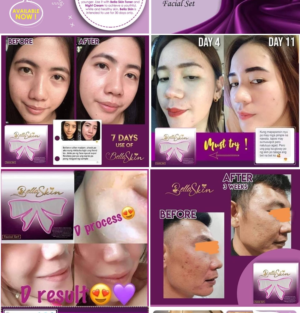 bella skin beauty